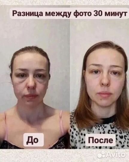 Драйнэффект