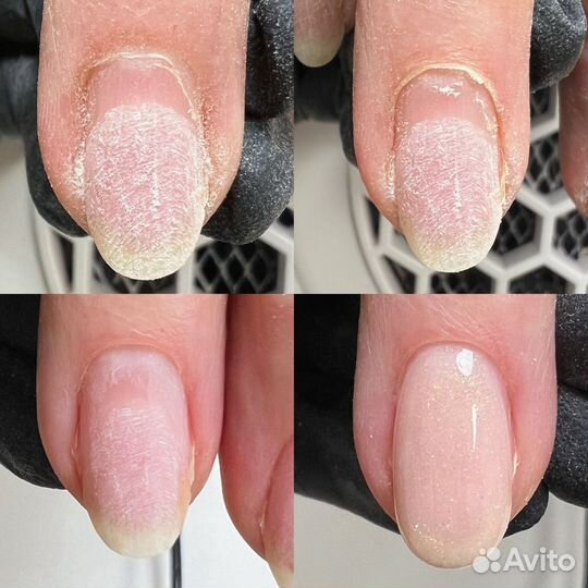 Маникюр, педикюр