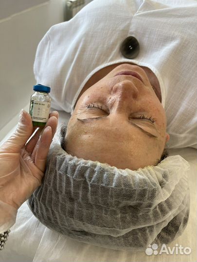 Пилинг biorepeelcl3