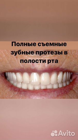 Съемные зубные протезы