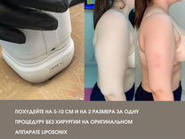 Моментальное похудение/за 1 сеанс/Липосоникс