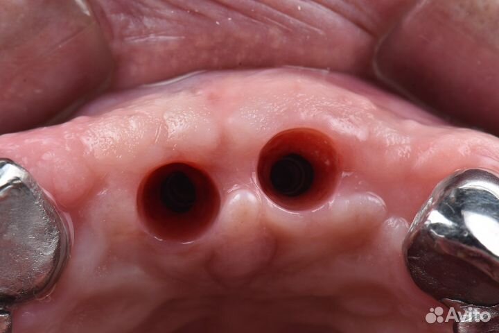 Хирург имплантолог