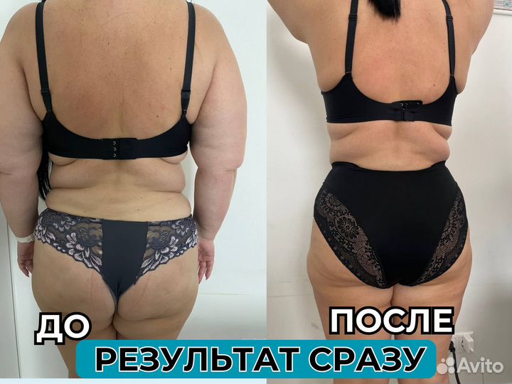 Аппаратный массаж / Массаж лпг / LPG