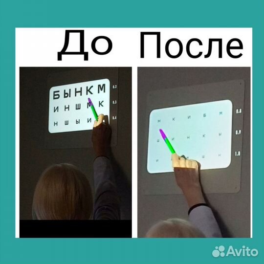 Кинезиомассаж