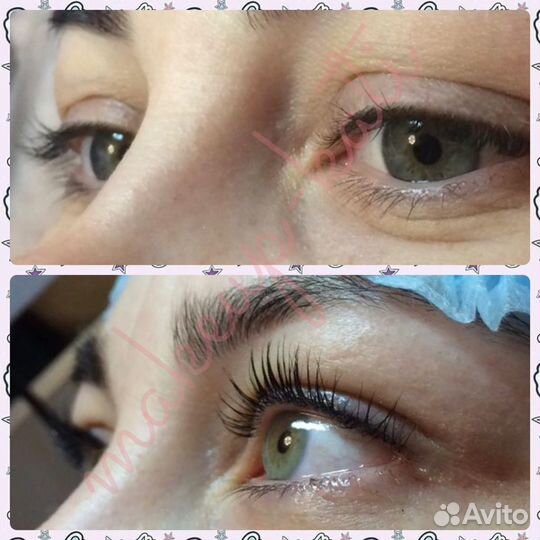 Ламинирование ресниц, ботокс