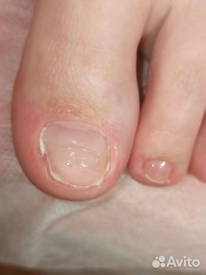 Подология, педикюр