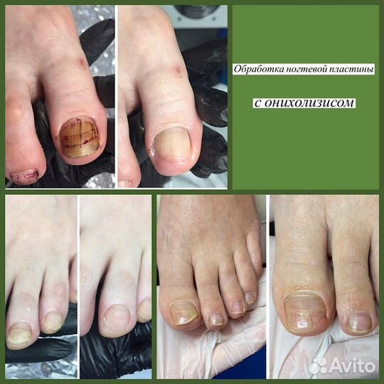 Подолог Педикюр Иваново