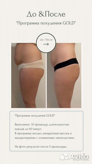 Программы похудения (Basic, Silver, Gold)