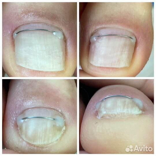 Услуги подолога