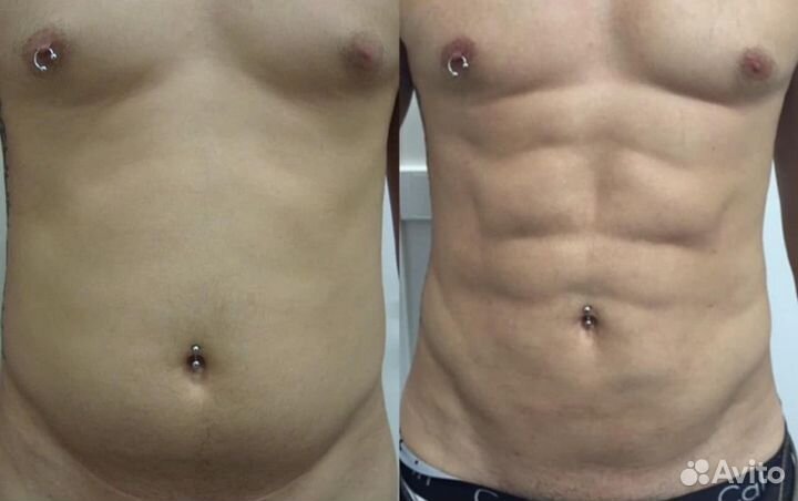 Массаж похудение