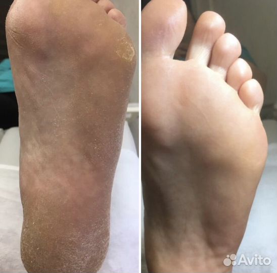 Педикюр, Подолог