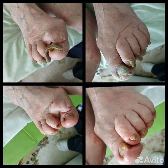 Гигиенический и эстетический педикюр (выезд на дом