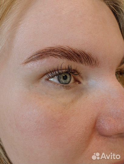 Брови ЖК Солнечный город