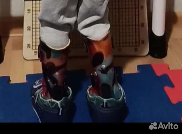 Аппарат на голеностоп