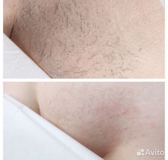 Массажистка,шугаринг