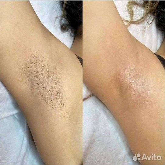 Шугаринг и прокол ушей