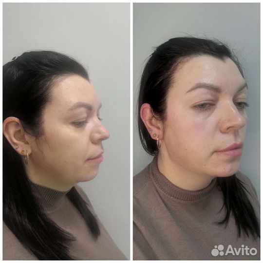 Косметолог.Лицо под ключ (Luxe Face)