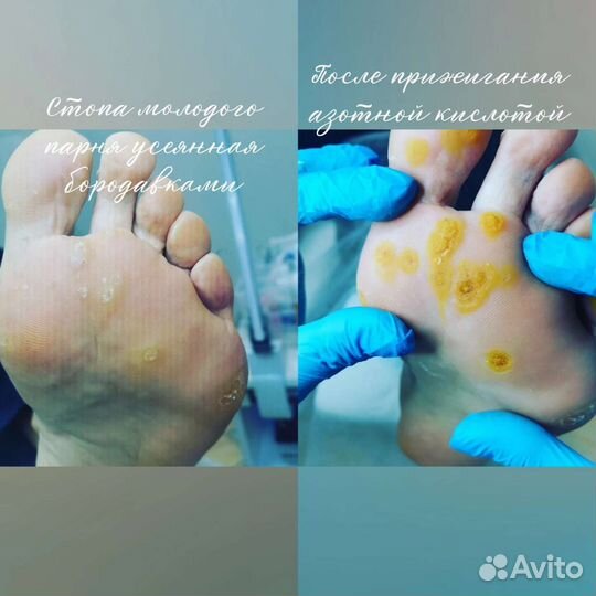 Услуги подолога