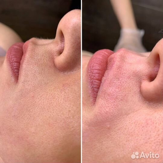 Восковая депиляция/Ставрополь/Парафинотерапия