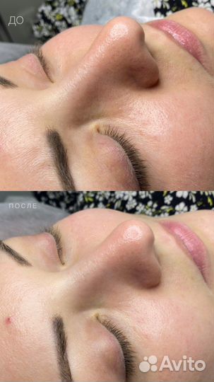 Услуги косметолога