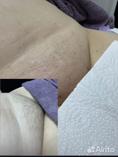 Мастер по шугарингу