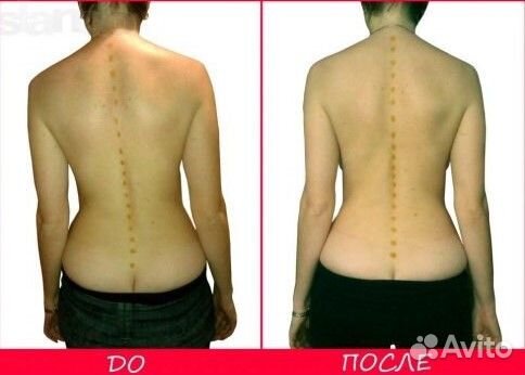 Массаж мануальный, костоправ. Результат с 1 сеанса