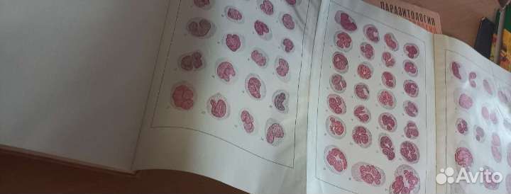 Атлас крови