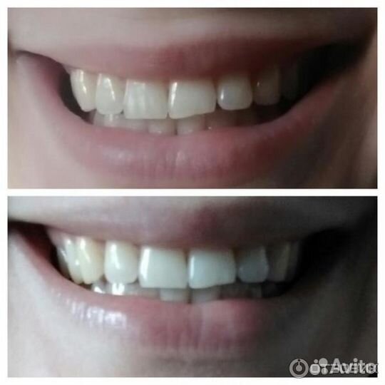 Отбеливающая зубная паста из Таиланда