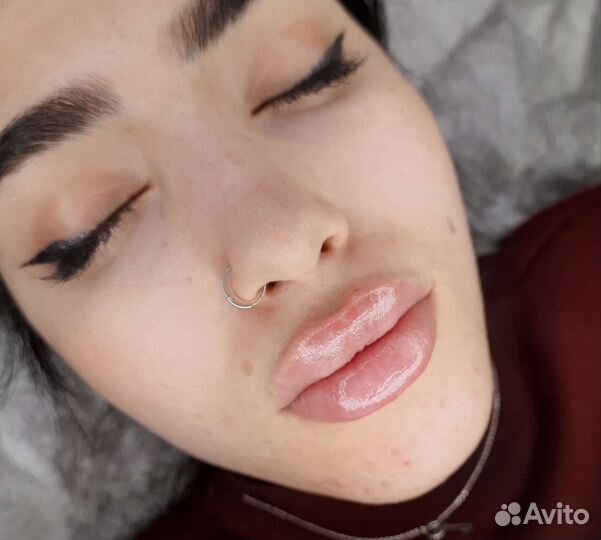 Увеличение губ
