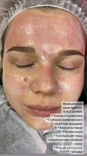 Услуги косметолога