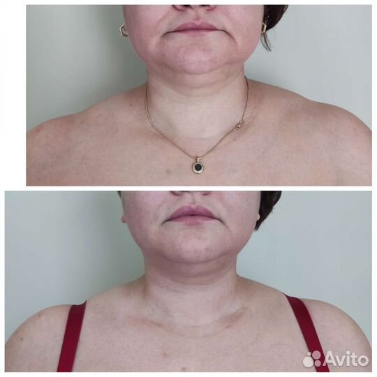 Массаж лица через тело