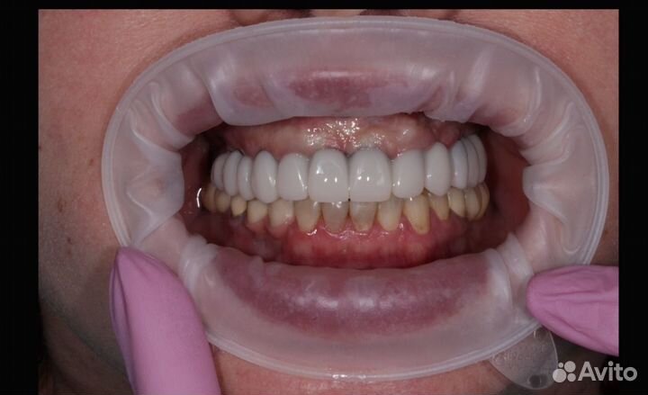 Моделирование Прототипы CAD\CAM зубной техник