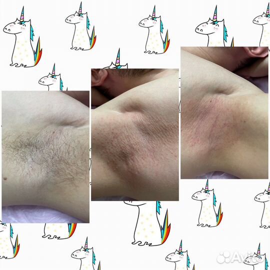 SPA-шугаринг/массаж/обертывание