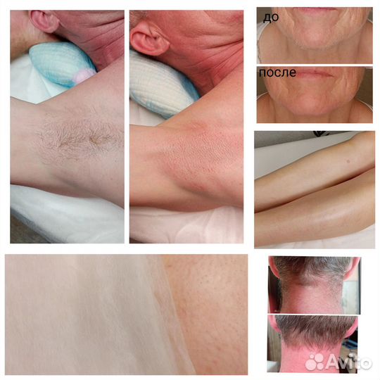 Брови, фитомассаж, депиляция