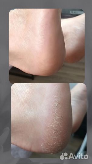 Маникюр, SMART педикюр