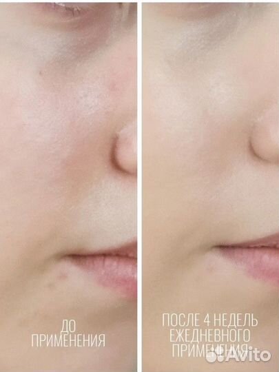 Сыворотка для лица корея