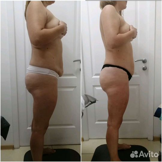 Коррекция фигуры, Ручная пластика лица, Уход