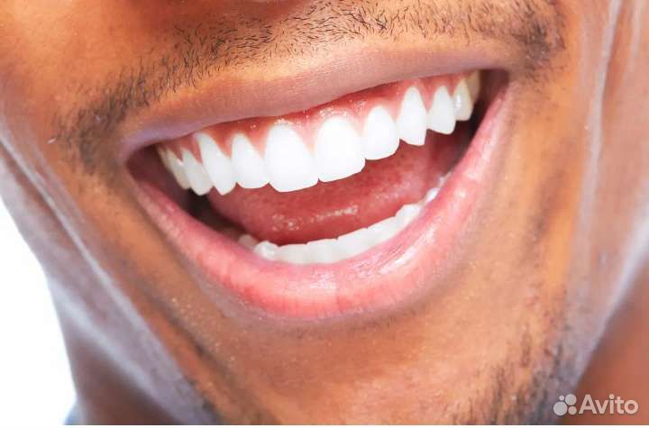 Профессиональные Стоматологические услуги