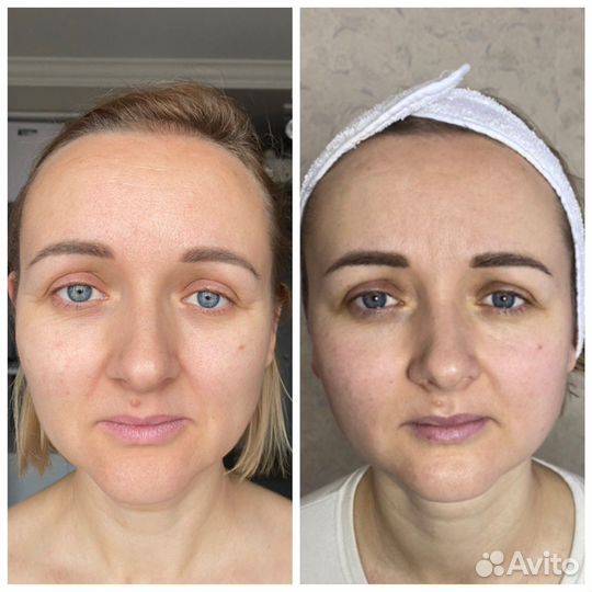 Краниосакральная телесная терапия, Биодинамика