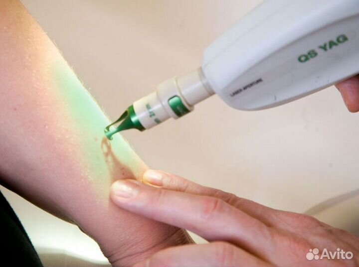 Продается готовый бизнес: салон эпиляции