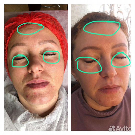 Пилинг для лица Биорепил