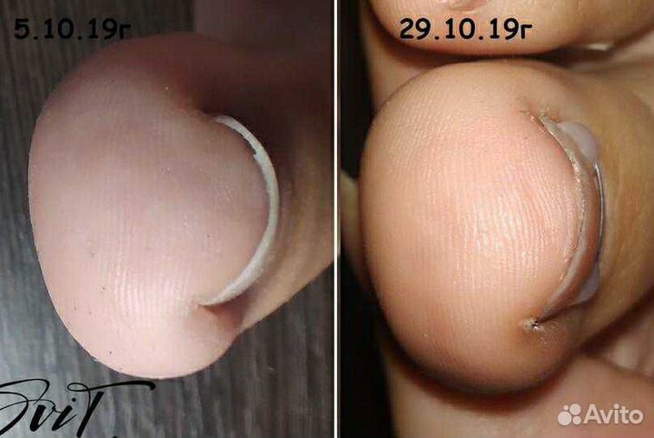 Педикюр. подология