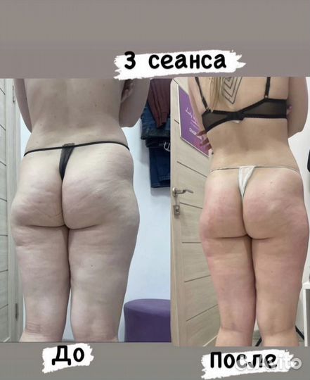 Профессиональный массаж тела