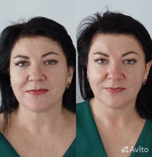 Массаж лица