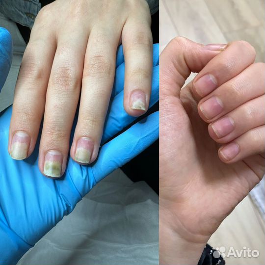 Подолог/Педикюр/Маникюр