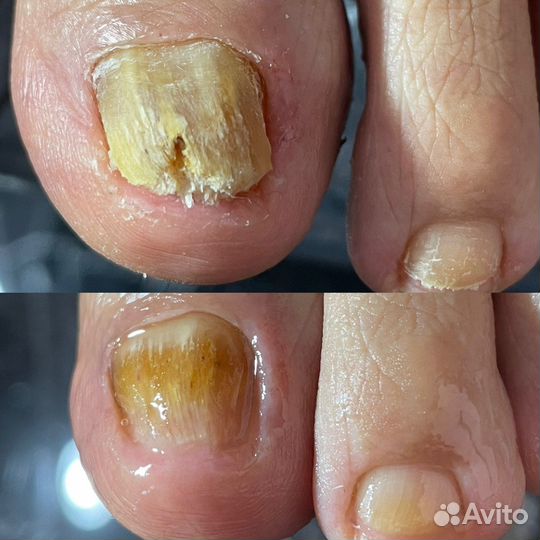 Педикюр маникюр