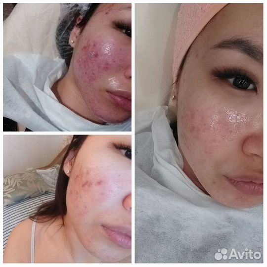 Косметолог - эстетист