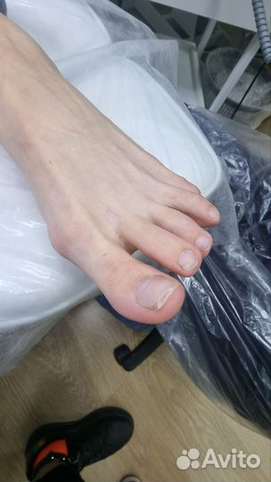 Услуги подолога