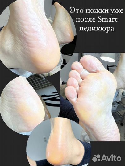 Smart - Педикюр