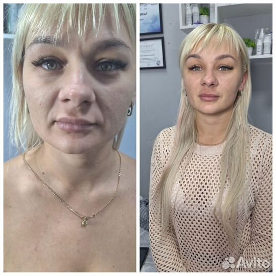 Услуги косметолога
